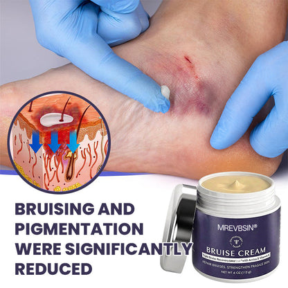 💥100K+ SOLD◻️ 𝐌𝐑𝐄𝐕𝐁𝑺𝑰𝑵® NEW Upgraded Bruise Repair Cream | Skin-Strengthening Formula for Easily Bruised Skin