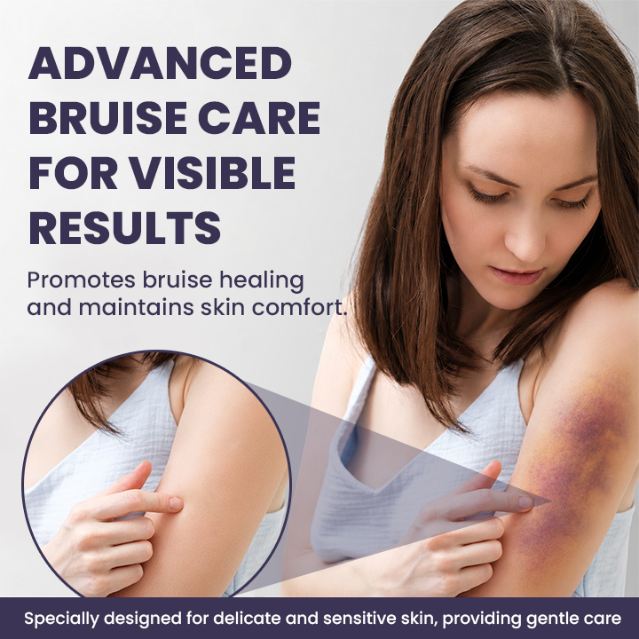 💥100K+ SOLD◻️ 𝐌𝐑𝐄𝐕𝐁𝑺𝑰𝑵® NEW Upgraded Bruise Repair Cream | Skin-Strengthening Formula for Easily Bruised Skin