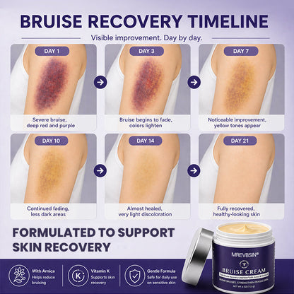 💥100K+ SOLD◻️ 𝐌𝐑𝐄𝐕𝐁𝑺𝑰𝑵® NEW Upgraded Bruise Repair Cream | Skin-Strengthening Formula for Easily Bruised Skin