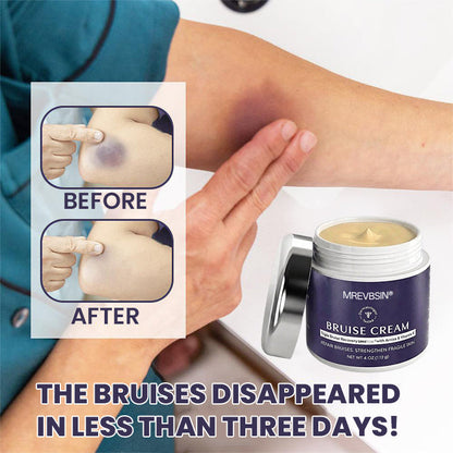 💥100K+ SOLD◻️ 𝐌𝐑𝐄𝐕𝐁𝑺𝑰𝑵® NEW Upgraded Bruise Repair Cream | Skin-Strengthening Formula for Easily Bruised Skin