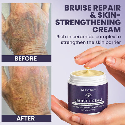 💥100K+ SOLD◻️ 𝐌𝐑𝐄𝐕𝐁𝑺𝑰𝑵® NEW Upgraded Bruise Repair Cream | Skin-Strengthening Formula for Easily Bruised Skin